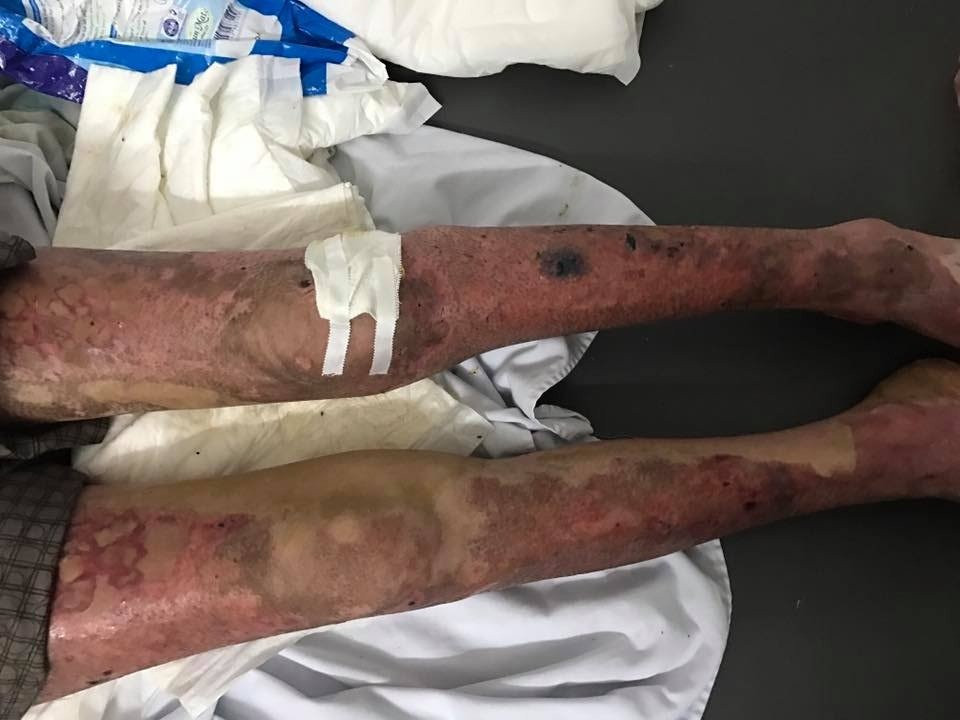 18952590_1925892300980571_1963095006560063448_n 4