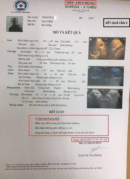 bvdk-16a-ha-dong-mot-benh-nhan-2-bac-si-kham-ra-ket-qua-khac-nhau-hinh-3 3