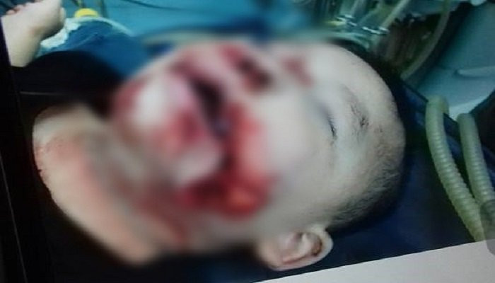 329408872301283144146395366600441381519360n-15268962578621993566601