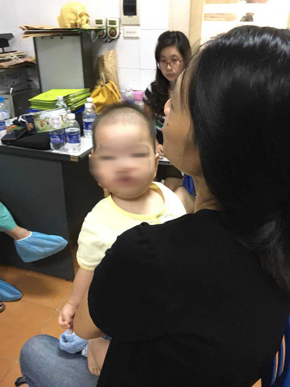 ky la chau be mac benh hiem gap keu nhu meo hinh anh 1