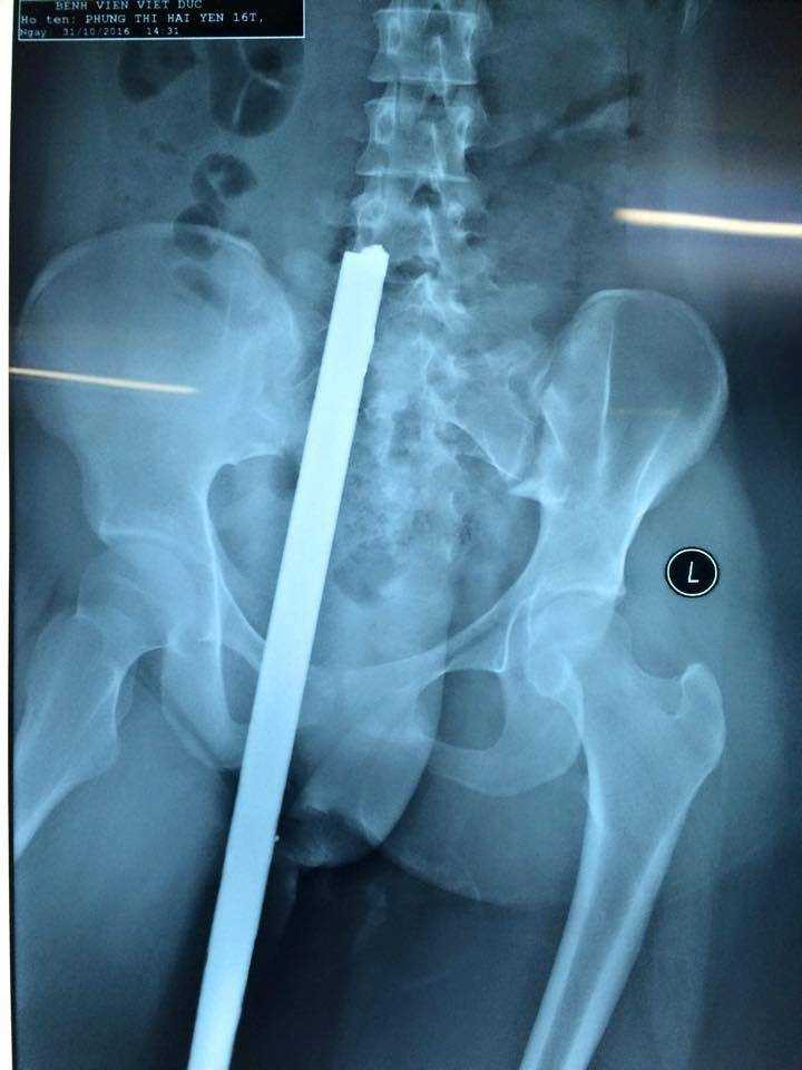 14956027_1298685420155080_3881514162689117477_n