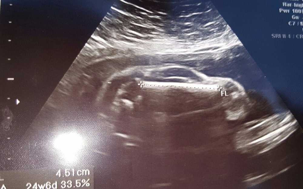 Fry65yGXMWdMJc4ofr7NQISR3wTPwG4klqTrJJgGUbM-xlarge_trans++rnKnv-EZ40EhYX8nU7dr8-dXsnpCz3tP6_Ws0MCzAGg