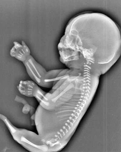 Ultrasound-of-baby-610423