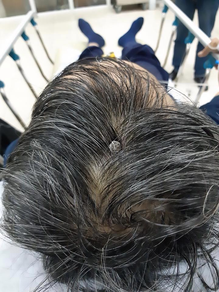 nintchdbpict000395234351