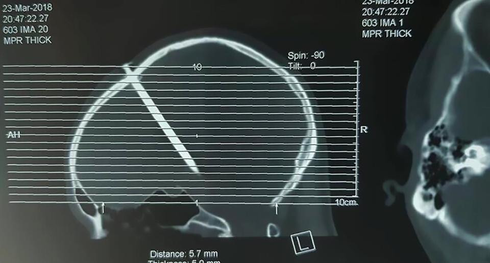 nintchdbpict000395234361