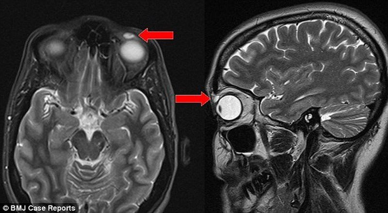 20180814-kinh-sat-trong-roi-nguoc-vao-mat-28-nam-sau-va-cham-1