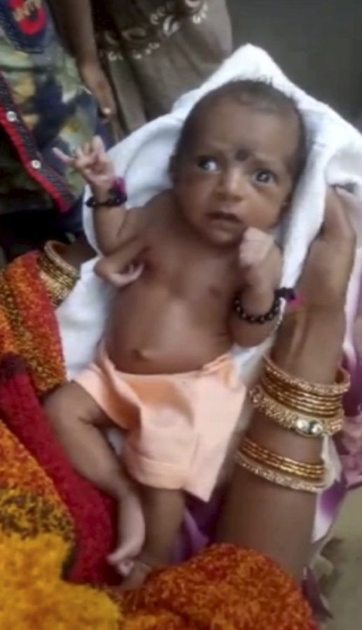 SWNS_THREEHANDED_BABY_03 4