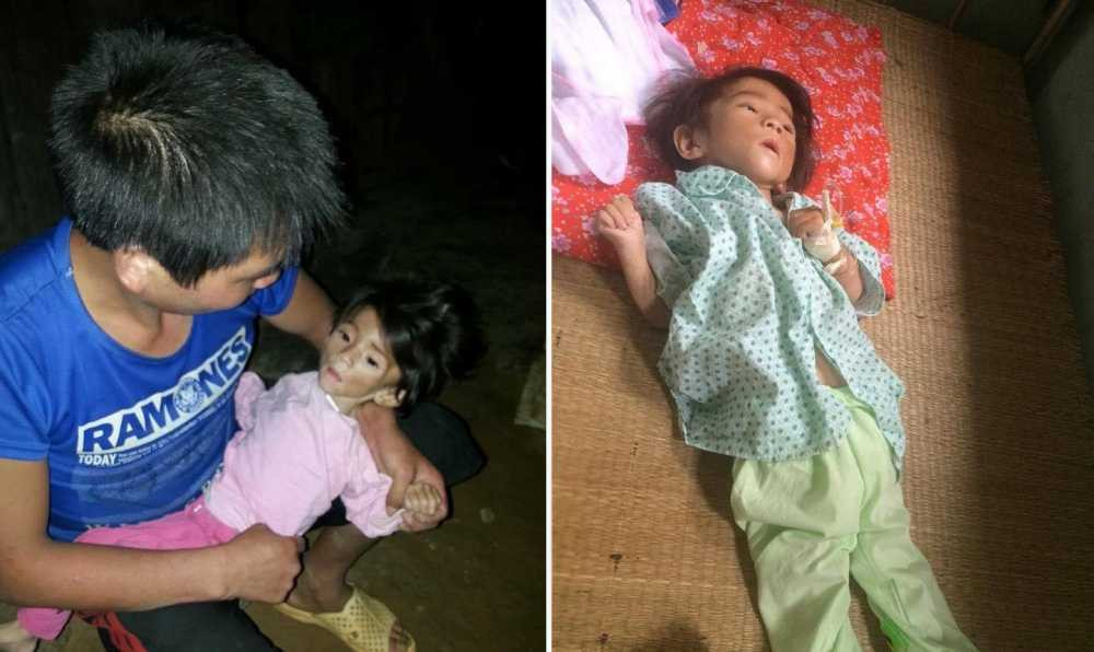 be-gai-nguoi-mong-bi-suy-dinh-duong-nang-1