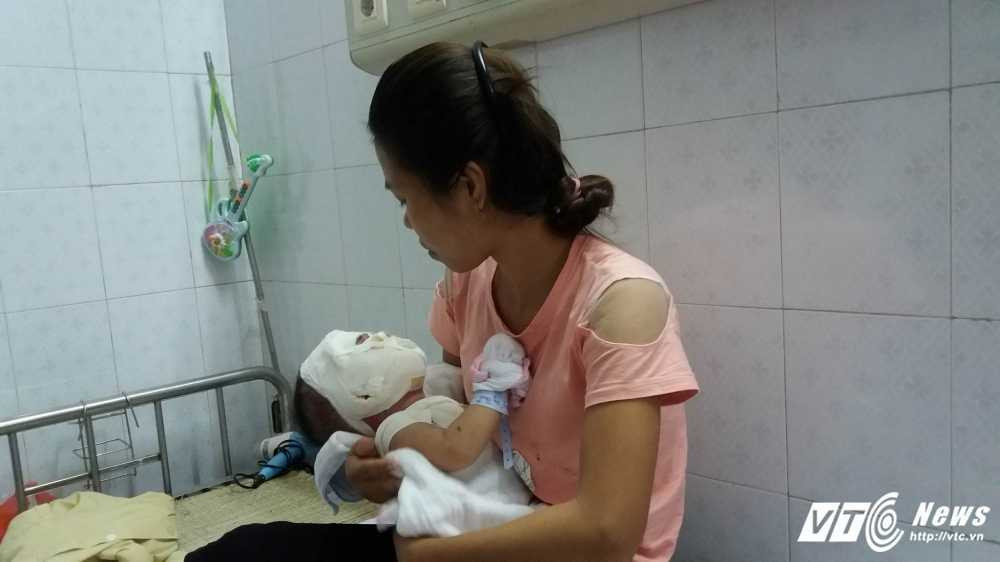 me-bat-can-con-trai-i-am-nuoc-soi-do-vao-dau-1