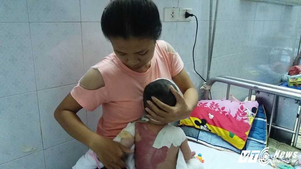 me-bat-can-con-trai-i-am-nuoc-soi-do-vao-dau-3