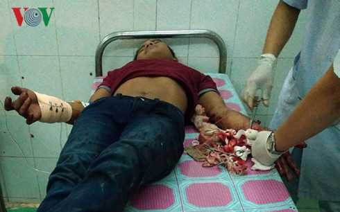 kien giang di chuc tet bi chem dut gan tay hinh 1