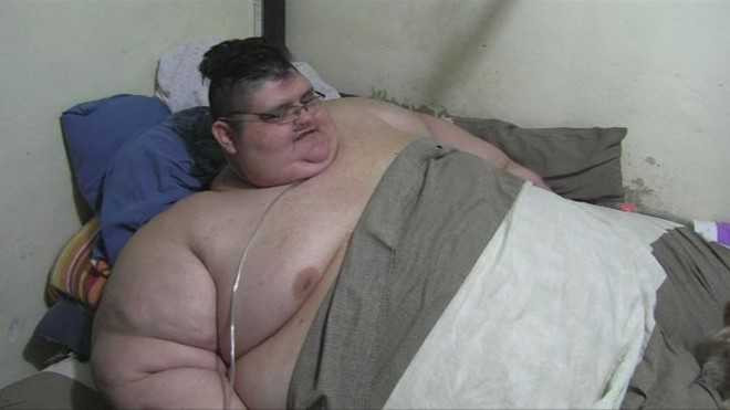 Chang trai Mexico beo nhat the gioi tim cach giu mang song hinh anh 1