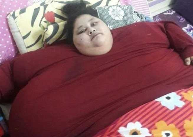 Nguoi phu nu nang nhat the gioi duoc phau thuat giam can hinh anh 1