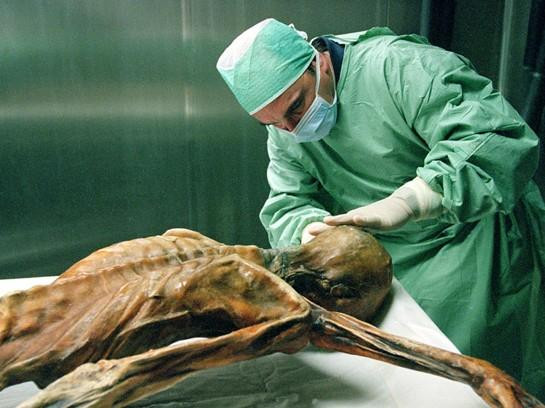 nhung_dieu_it_biet_ve_xac_uop_nguoi_bang_otzi_jpg5 3