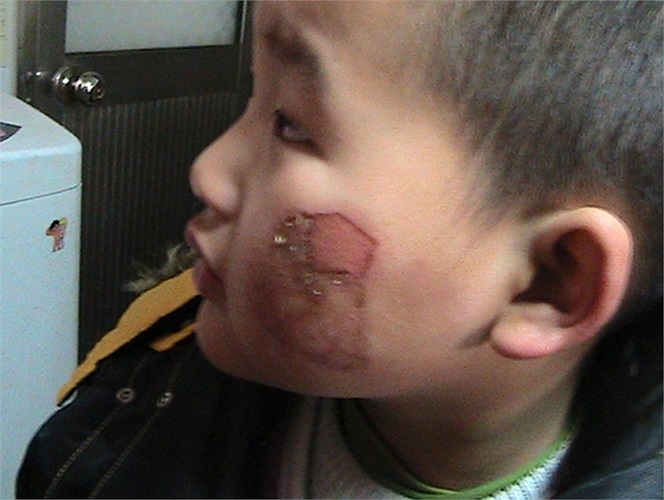 Không chỉ ở Việt Nam mà ngay cả Trung Quốc cũng có những cảnh bạo hành trẻ em tàn bạo vô nhân tính