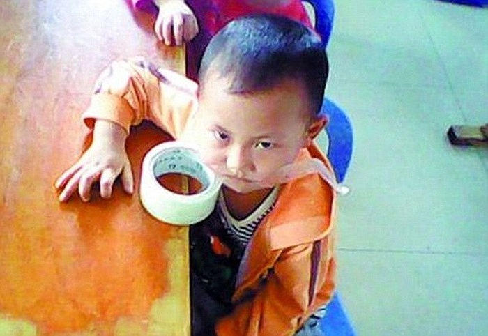 Một em nhỏ khác bị dán băng dính quanh miệng