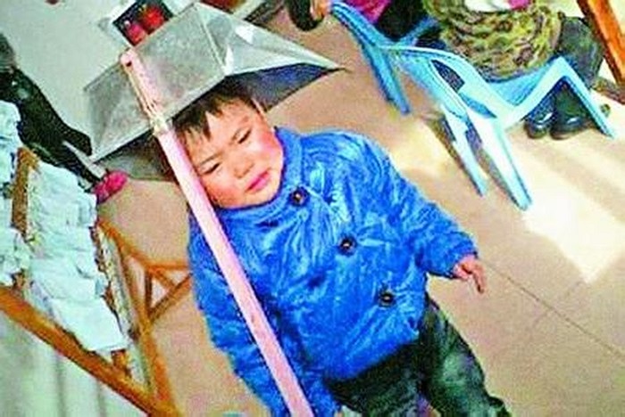 Bé trai bị úp gầu hót rác lên đầu