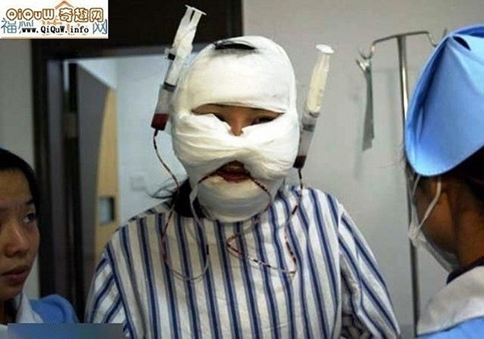 Những phụ nữ tìm tới phẫu thuật chuyển đổi giới tính mong thay đổi bản thân