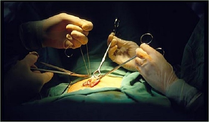 Cận cảnh những hình ảnh phẫu thuật chuyển giới