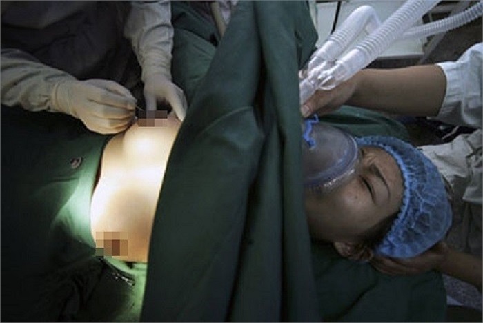 Nhiều cô gái biến thành chàng trai nam tính nhờ phẫu thuật thẩm mỹ 