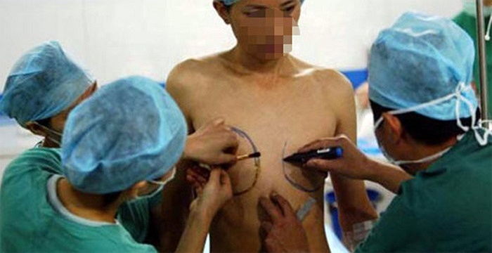 Các bác sĩ xác định vị trí cần mổ trong ca phẫu thuật chuyển giới từ nam sang nữ 