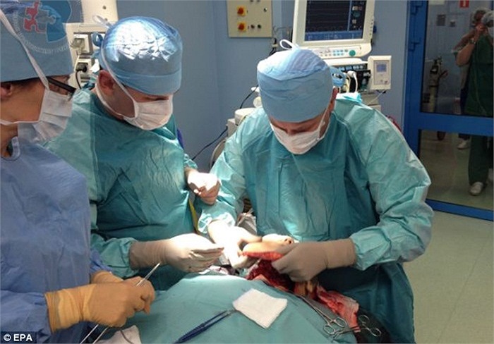 Các bác sĩ đang lột da mặt của Joana