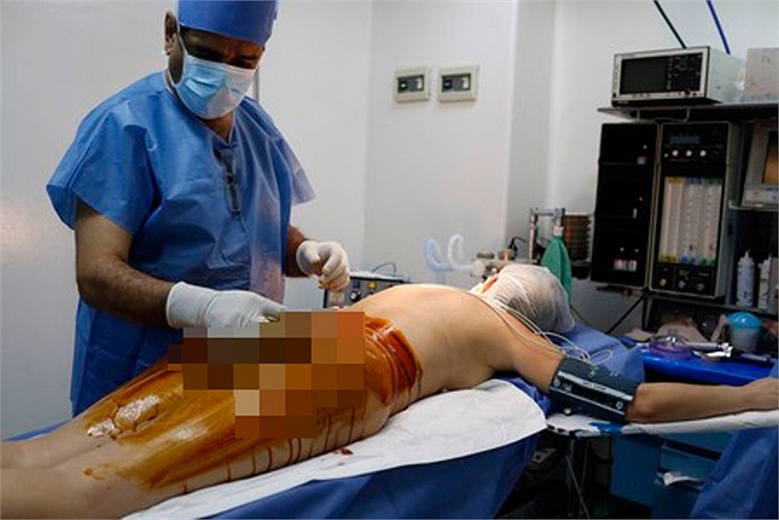 Một bác sỹ đang giúp bệnh nhân lau sạch và bôi thuốc vào vùng phẫu thuật.