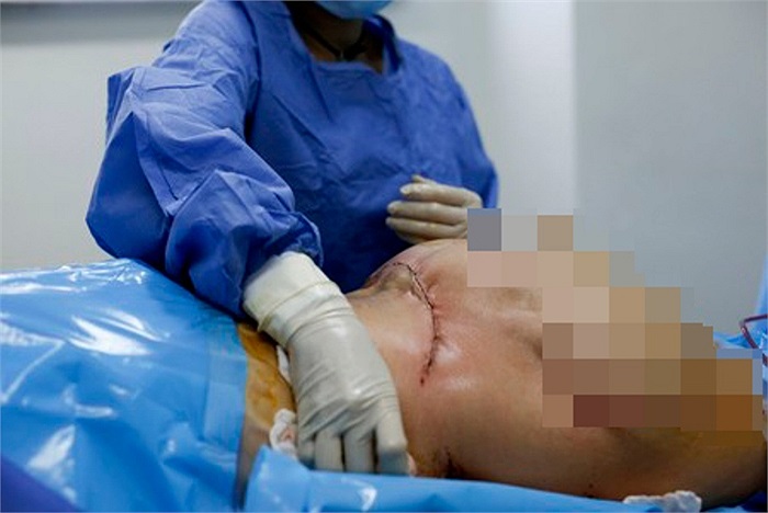 Kết thúc ca phẫu thuật, một y tá sẽ hỗ trợ vệ sinh và khử trùng cho bệnh nhân.