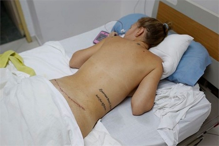 Bệnh nhân đang trong quá trình hồi phục sau 1 ngày lấy bỏ túi silicon.