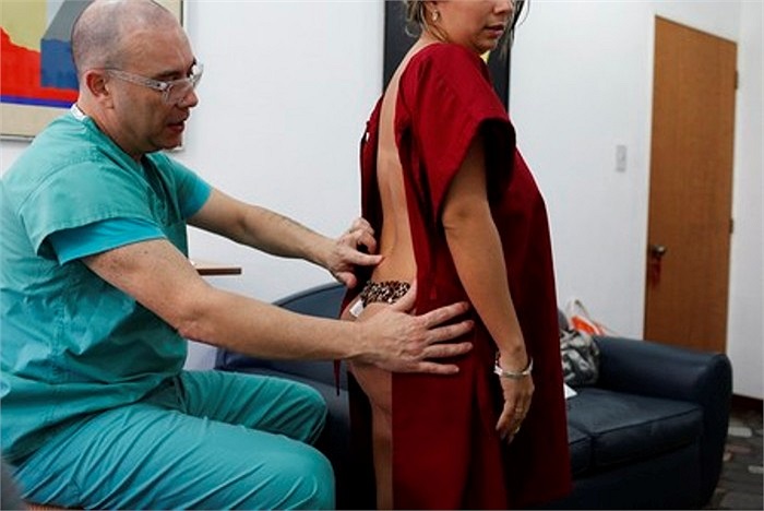 Được biết, ca phẫu thuật lấy bỏ túi độn có giá khoảng 8.200 USD, và kéo dài trong khoảng 2 đến 3 giờ đồng hồ.