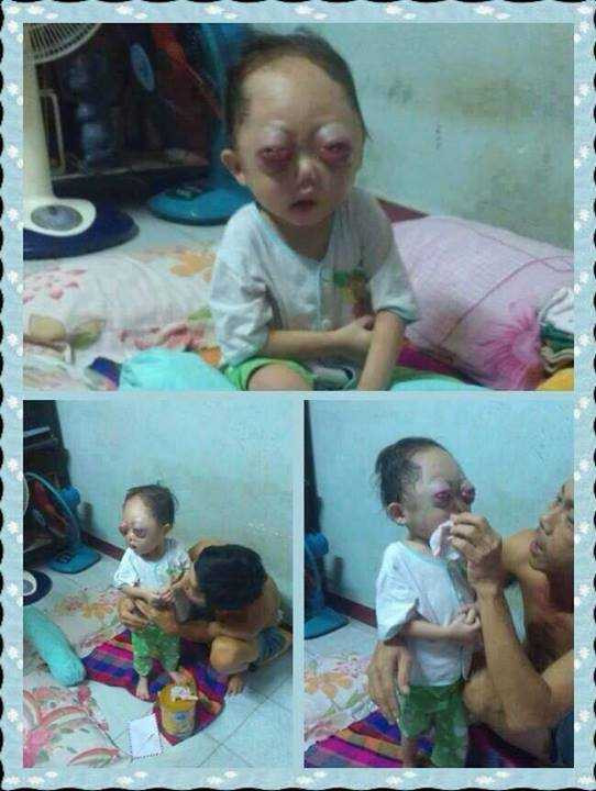 ung thư máu, bé Huỳnh Bảo Trân, BV máu huyết học