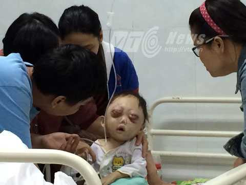 ung thư máu, bé Huỳnh Bảo Trân, BV máu huyết học