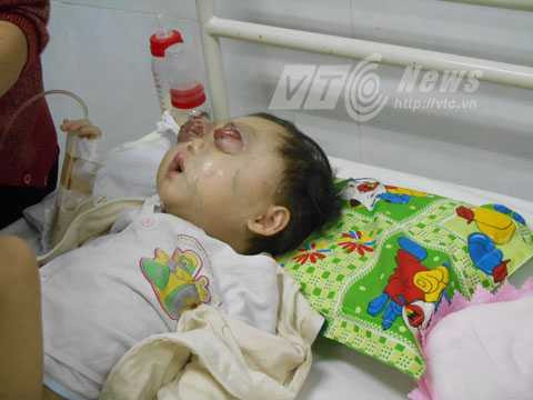 ung thư máu, bé Huỳnh Bảo Trân, BV máu huyết học