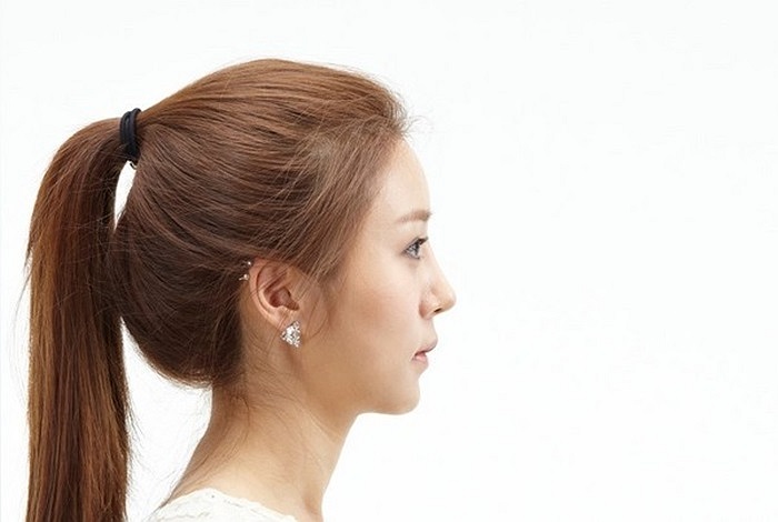 ...trở nên thon gọn sau phẫu thuật