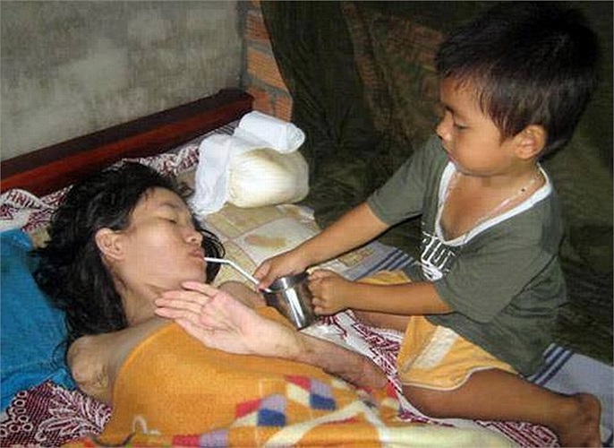 Trên chiếc giường ọp ẹp, ngày ngày cậu bé 3 tuổi Nguyễn Gia Huy (huyện Định Quán, Đồng Nai) vừa bóp tay bóp chân, lúc lại lấy nước, pha sữa, bón cháo cho người mẹ nằm co quắp, teo tóp như một cái xác không hồn.