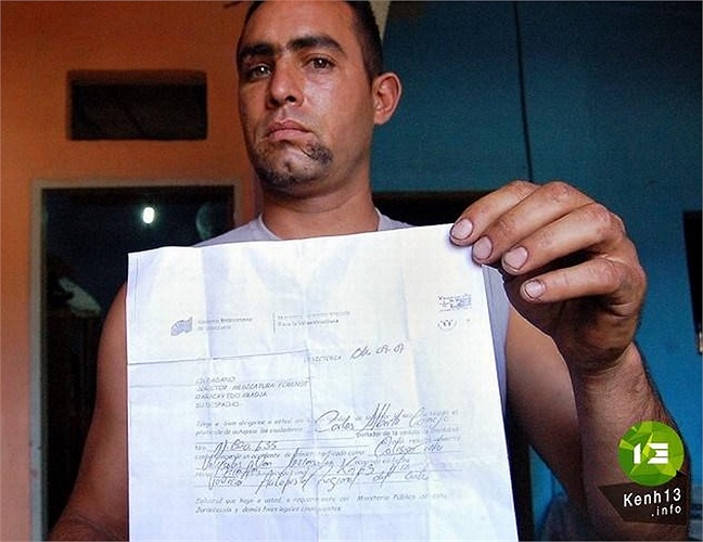 Năm 33 tuổi, Carlos Camejo bị thương trong vụ va chạm trên đường cao tốc ở Venezuela. Giám định pháp y thông báo nạn nhân đã chết. Không lâu sau, người vợ đến nhận diện thi thể đã vỡ òa sung sướng khi biết chồng vẫn còn sống.