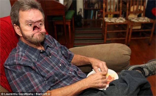 Khuôn mặt ông đã được các bác sỹ phẫu thuật mới được thế này.