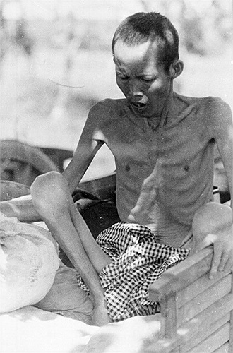 Người dân Campuchia bị đày đọa trong chế độ diệt chủng Pônpốt. Hàng triệu người Campuchia đã bị giết trong những năm cầm quyền của khơ me đỏ tại nước này. (Ảnh: TTXVN)