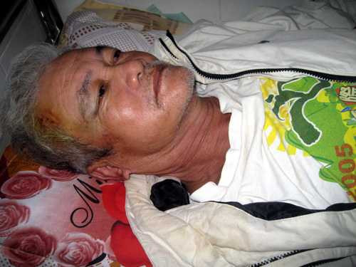 Ông Huỳnh Xuân Phước (63 tuổi) bị Phó Giám đốc Sở Tư pháp đánh nhập viện. Ảnh: TNO