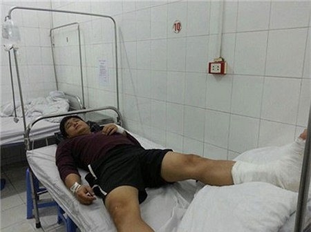 Minh Tiệp nhập viện vì ngã ngựa khi đang tập cho Cặp đôi hoàn hảo. Hình ảnh này cũng là bằng chứng thuyết phục để anh đã rút lui khỏi cuộc thi ngay sau đó vì tai nạn này. 