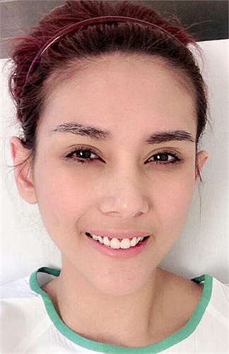 Nằm trong phòng cấp cứu, chân dài vẫn pose ảnh, gương mặt cô thậm chí rất hồng hào, xinh đẹp. 