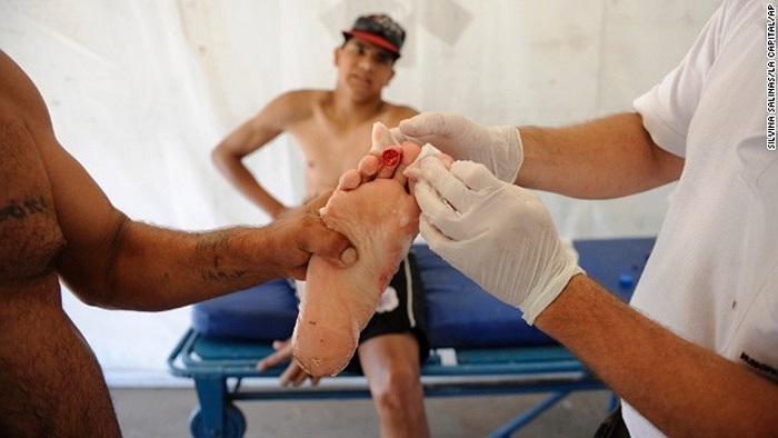 Một du khách bị cá Piranha tấn công ở Argentina đúng dịp Giáng sinh