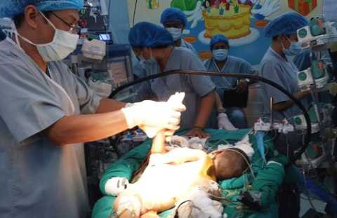 TP.HCM, bệnh viện Nhi Đồng 2, tách rời, song sinh.