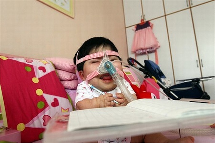 Các bác sĩ vẫn chưa thể chẩn đoán nguyên nhân gây ra tình trạng chậm phát triển như thế ở Pei Shan.