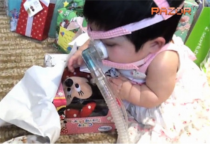 là một rối loạn phát triển làm ảnh hưởng đến não và tủy sống(hệ thống thần kinh trung ương).