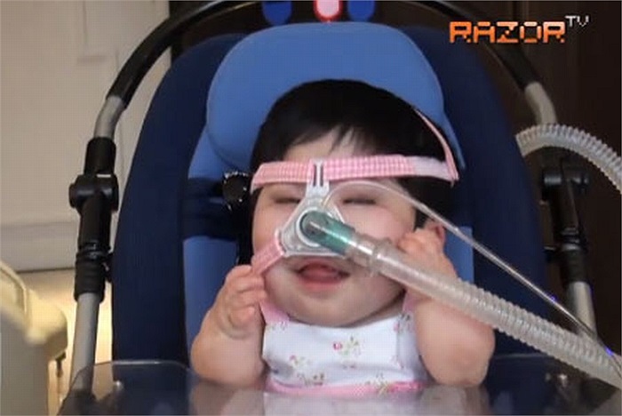 Pei Shan vẫn phải ngồi xe đẩy