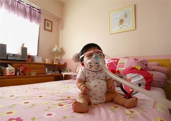 Bé Pei Shan chào đời và phát triển bình thường giống như bất kỳ đứa trẻ nào khác. 