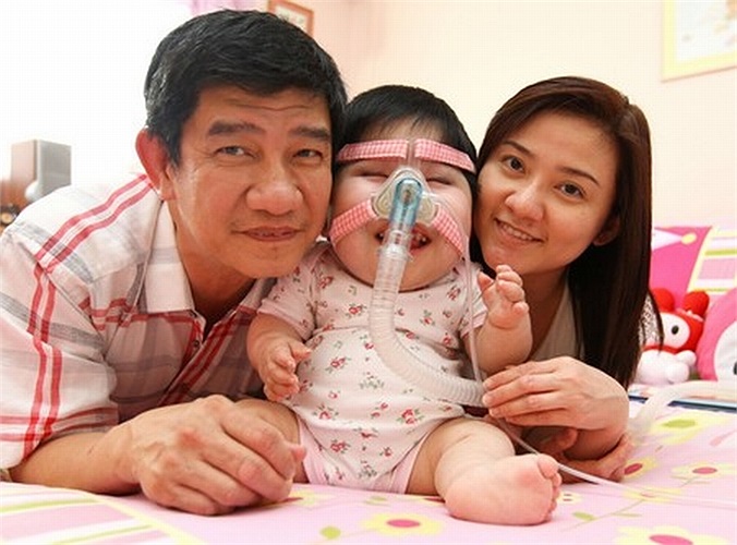 Tuy nhiên, khi được 3 tháng tuổi, cô bé Pei Shan bắt đầu ngừng phát triển. 