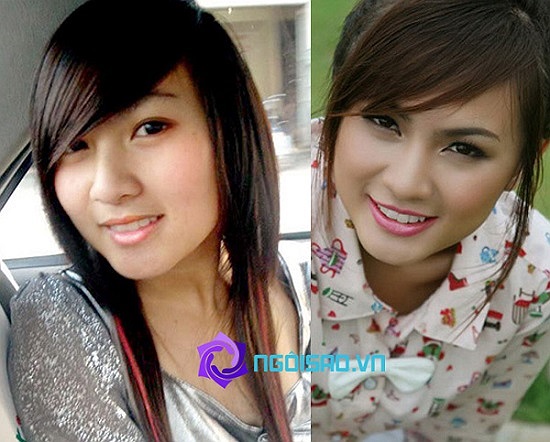Kelly Nguyễn vốn là hot girl nổi tiếng với khuôn mặt bầu bĩnh, đáng yêu nhưng vì chạy theo xu thế 'cằm nhọn' cô đã quyết định dao kéo.