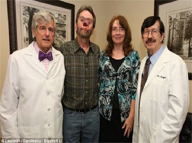 Sau khi phẫu thuật năm 2003, mặt ông Donnie (thứ 2 từ trái) đã bị biến dạng đáng sợ.